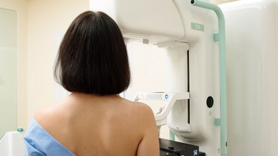 rejuvenation vaginale Paris - Dr Marie Mikayelyan